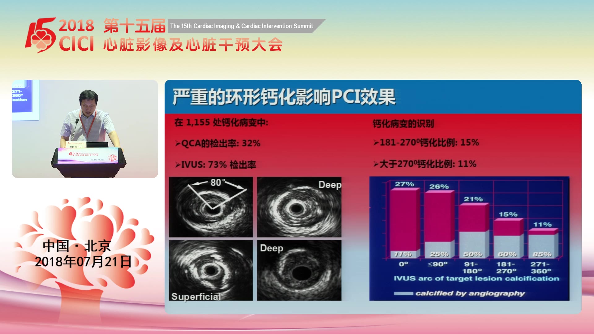 钙化病变旋磨是最终武器吗？