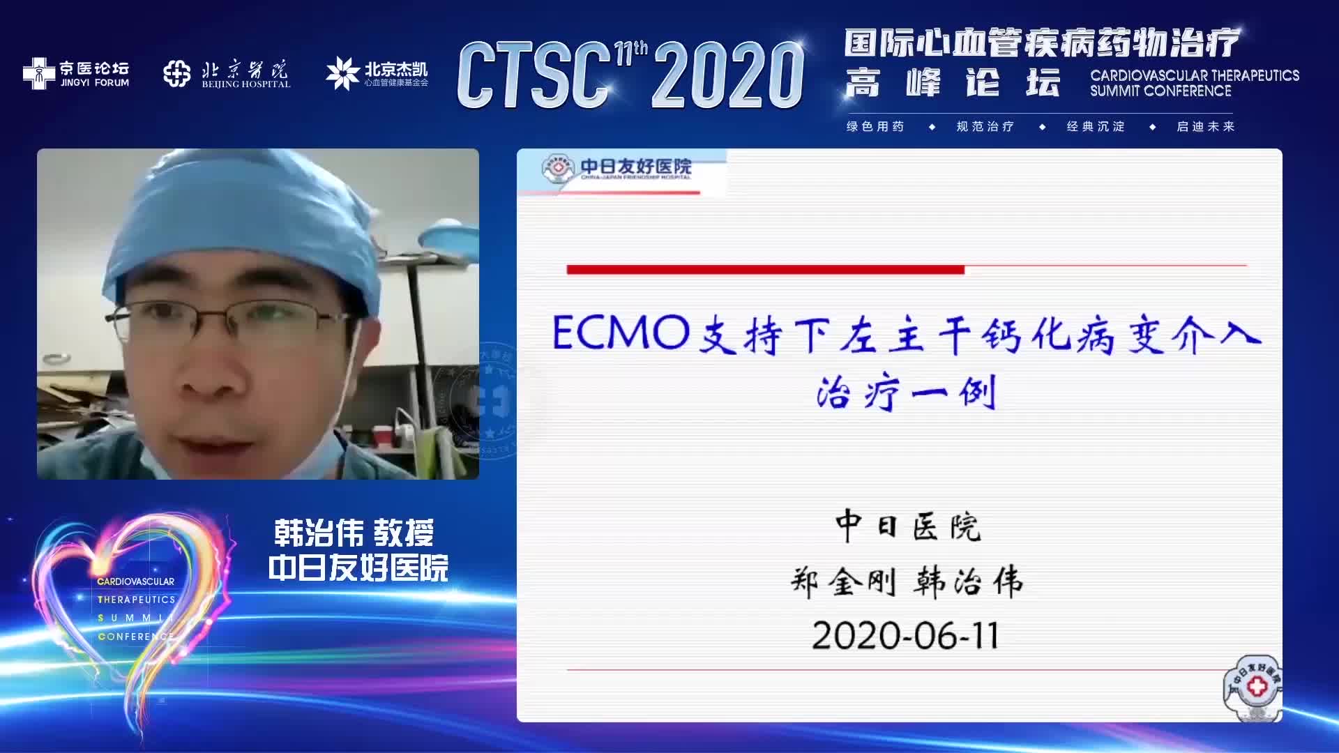 韩治伟  ECMO支持下介入治疗一例