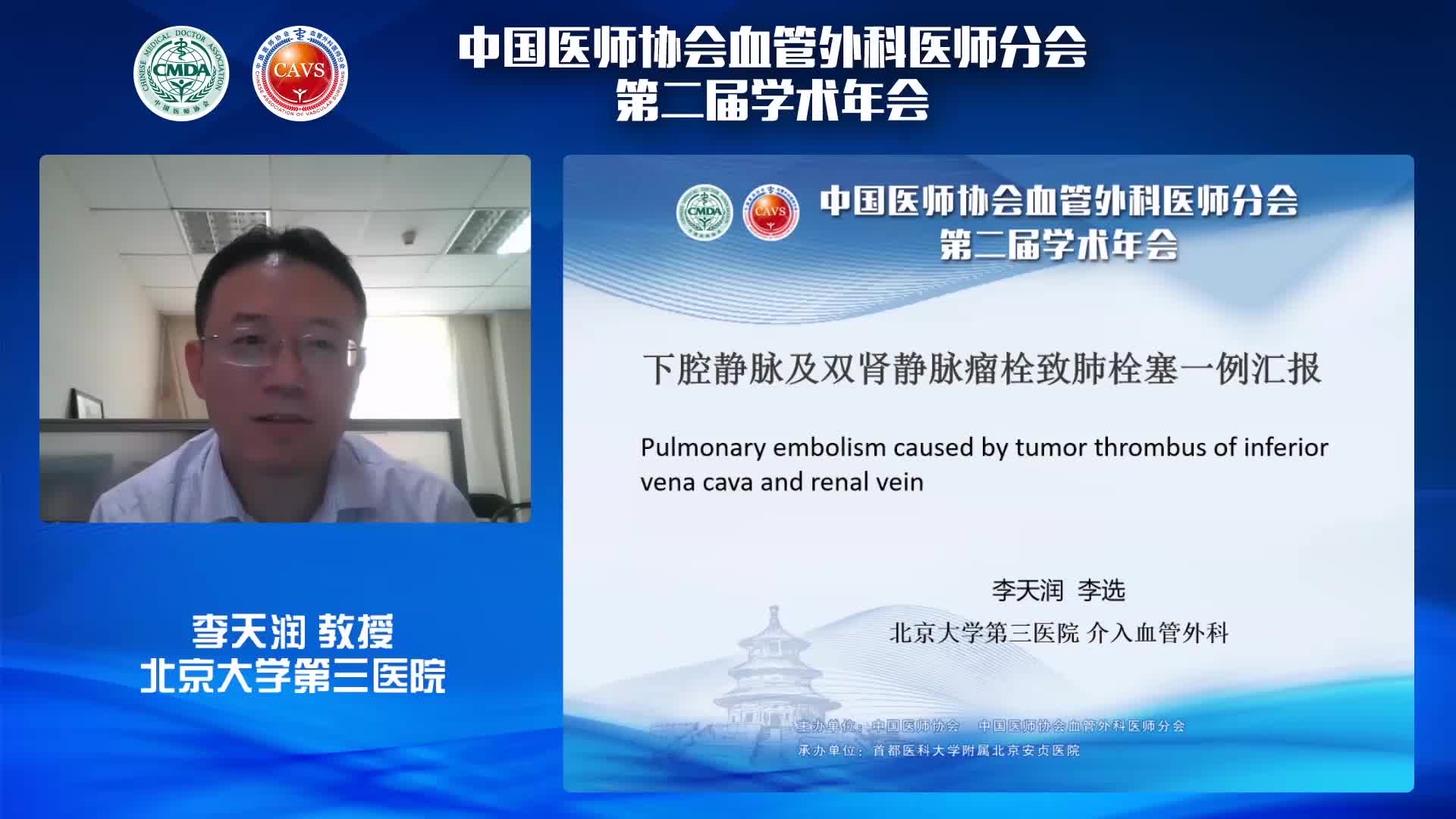 李天润-下腔静脉及双肾静脉瘤栓致肺栓塞一例汇报