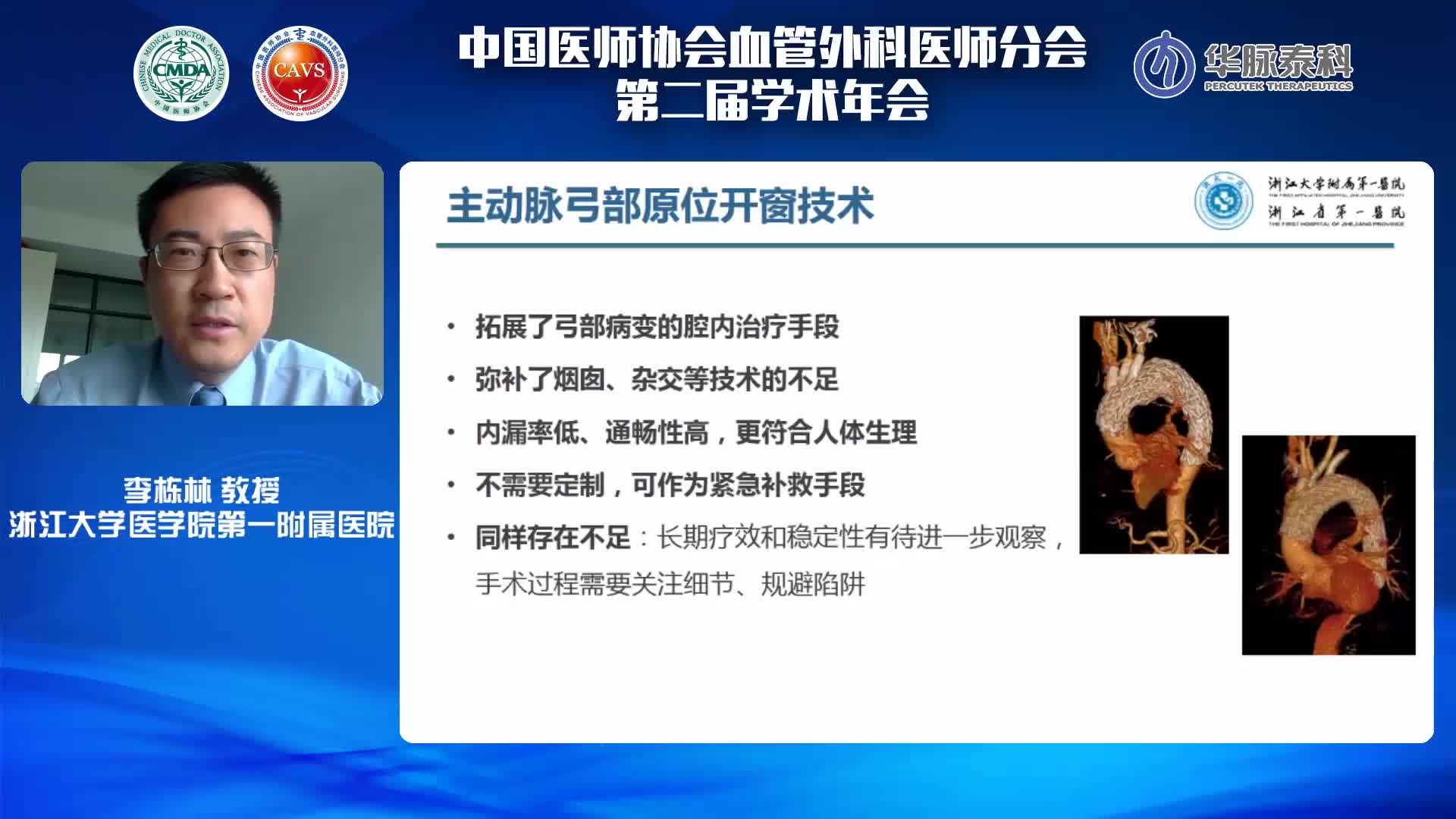 李栋林-主动脉弓机械针刺原位开窗的要点细节