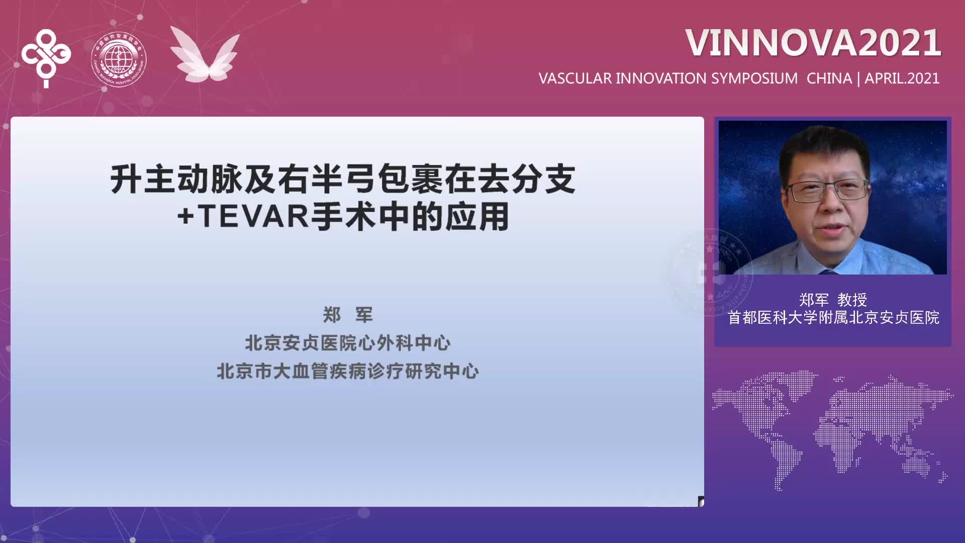 郑军-升主动脉及右半弓包裹成形在Debranch+TEVAR术中的应用