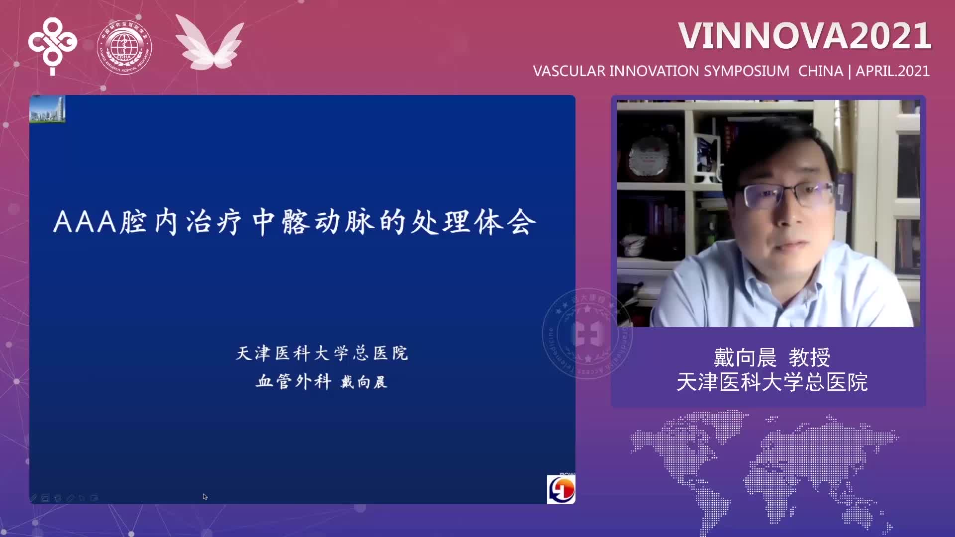 戴向晨-腹主动脉瘤EVAR治疗中髂动脉的处理体会