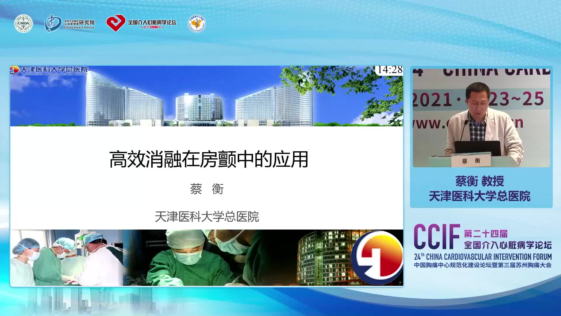 蔡衡-房颤高效消融