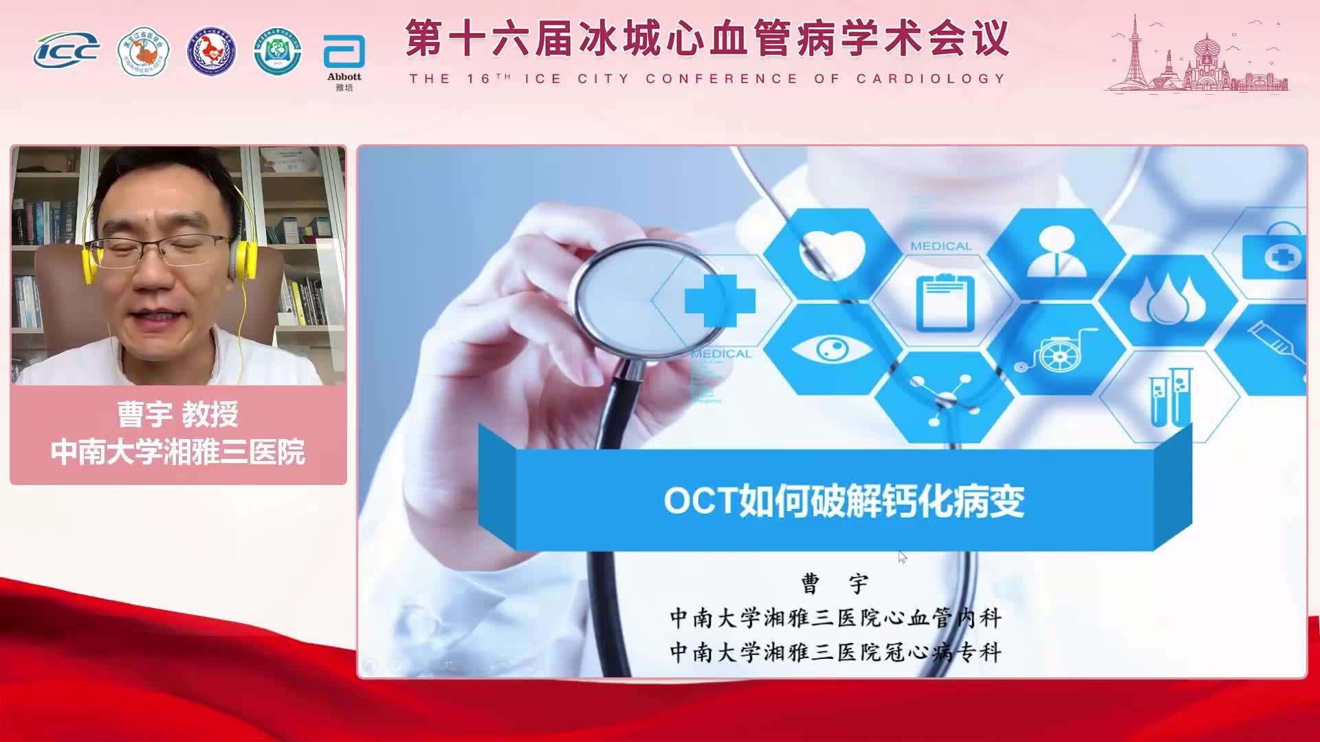 曹宇-挑战: OCT指导的钙化病变治疗