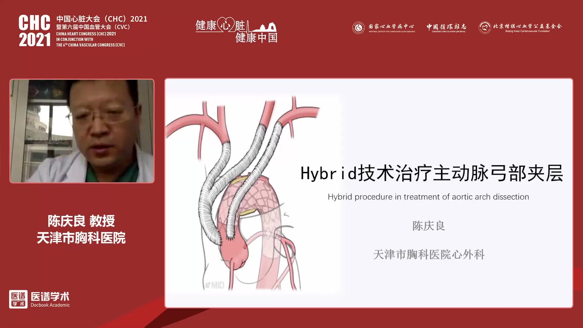 陈庆良-运用杂交技术重建弓上分支动脉的体会与思考