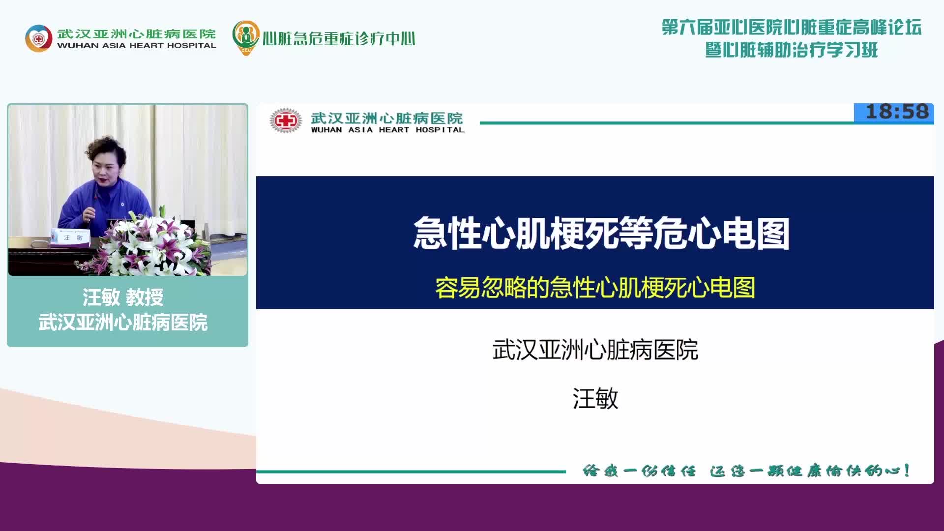 汪敏-急性心肌梗死等危心电图