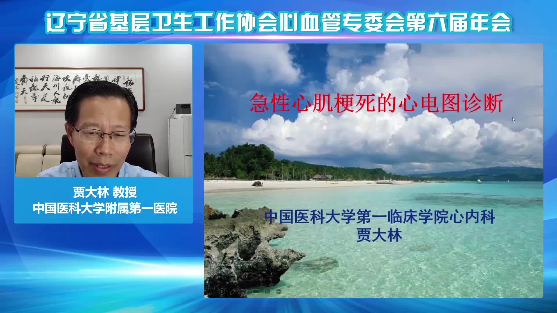 贾大林-急性心肌梗死的心电图诊断