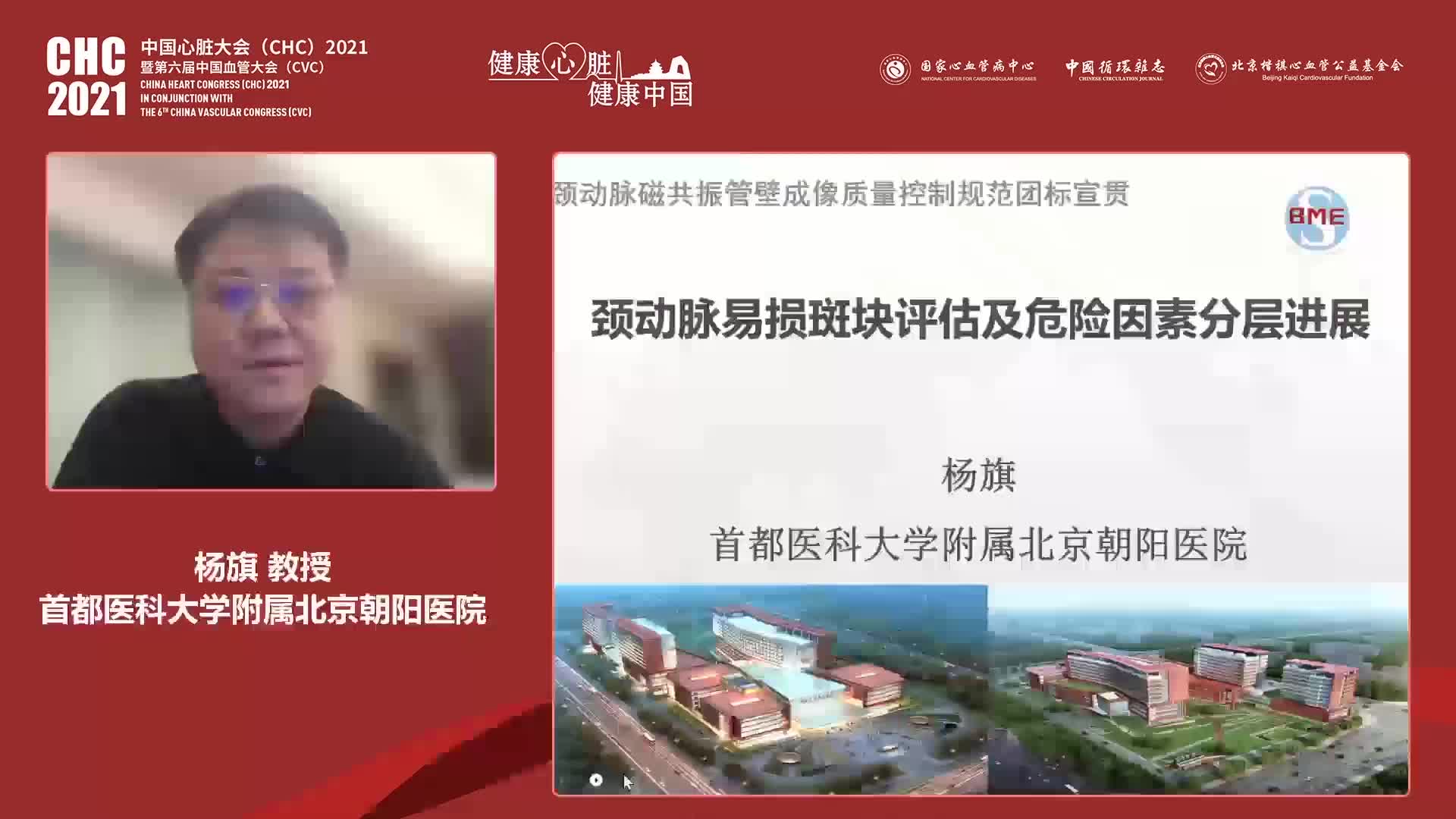 杨旗--颈动脉易损斑块评估及危险因素分层进展