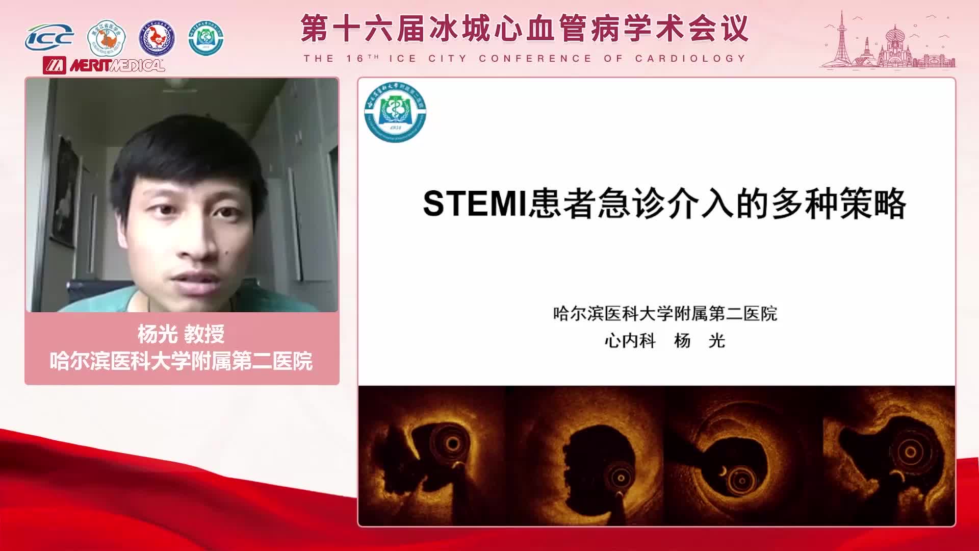 杨光 STEMI患者急诊介入治疗的多种策略
