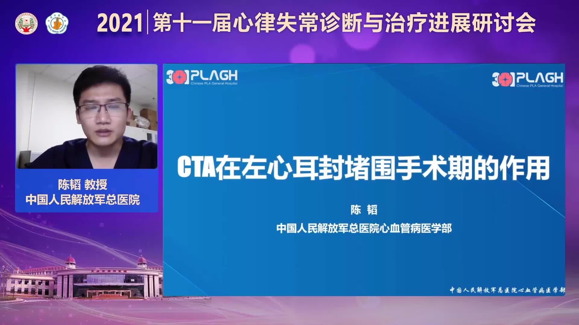 陈韬-CTA在左心耳封堵围术期的作用