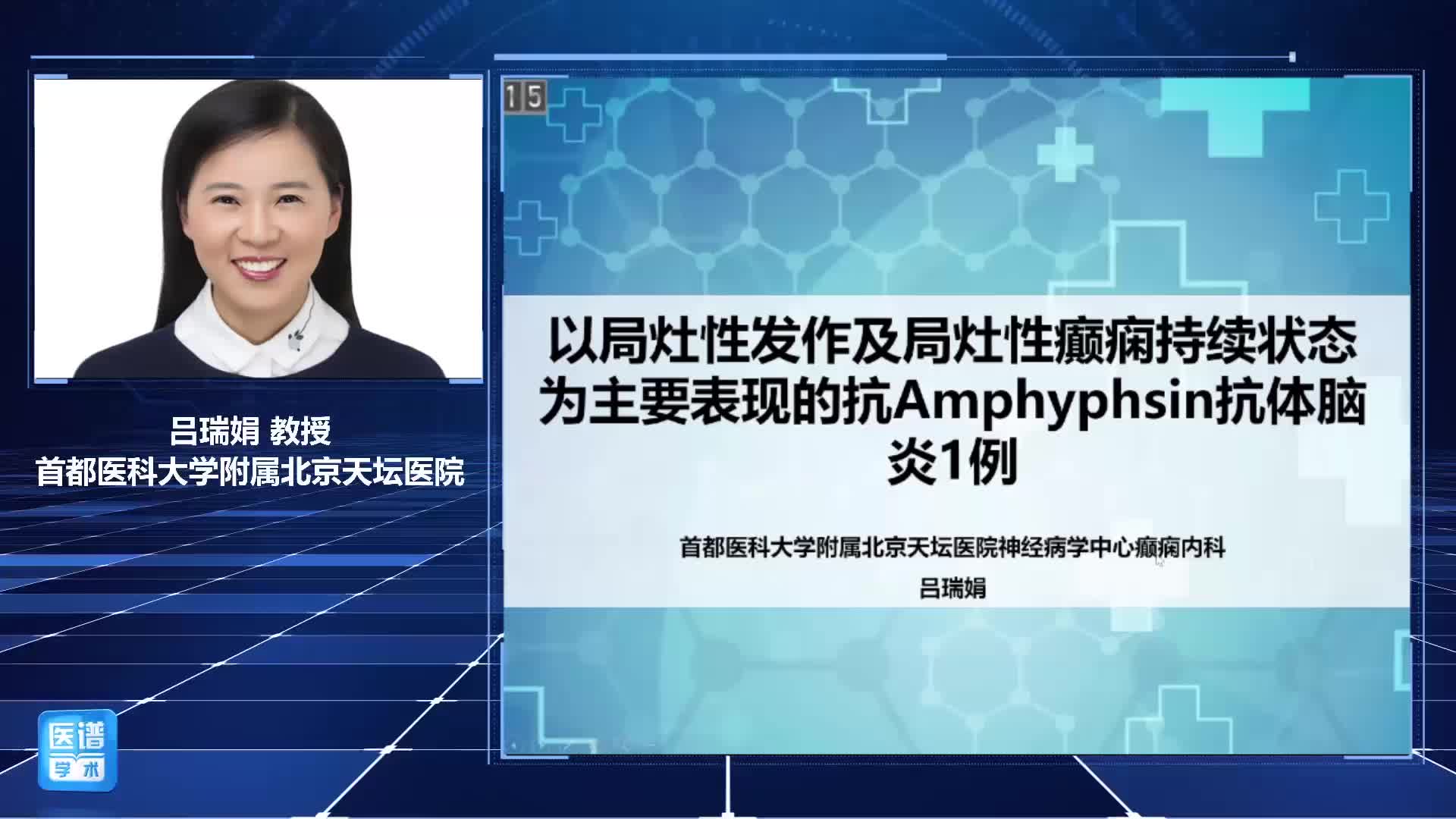 吕瑞娟-以局灶性发作及局灶性癫痫持续状态为主要表现的抗Amphyphsin 抗体脑炎1例