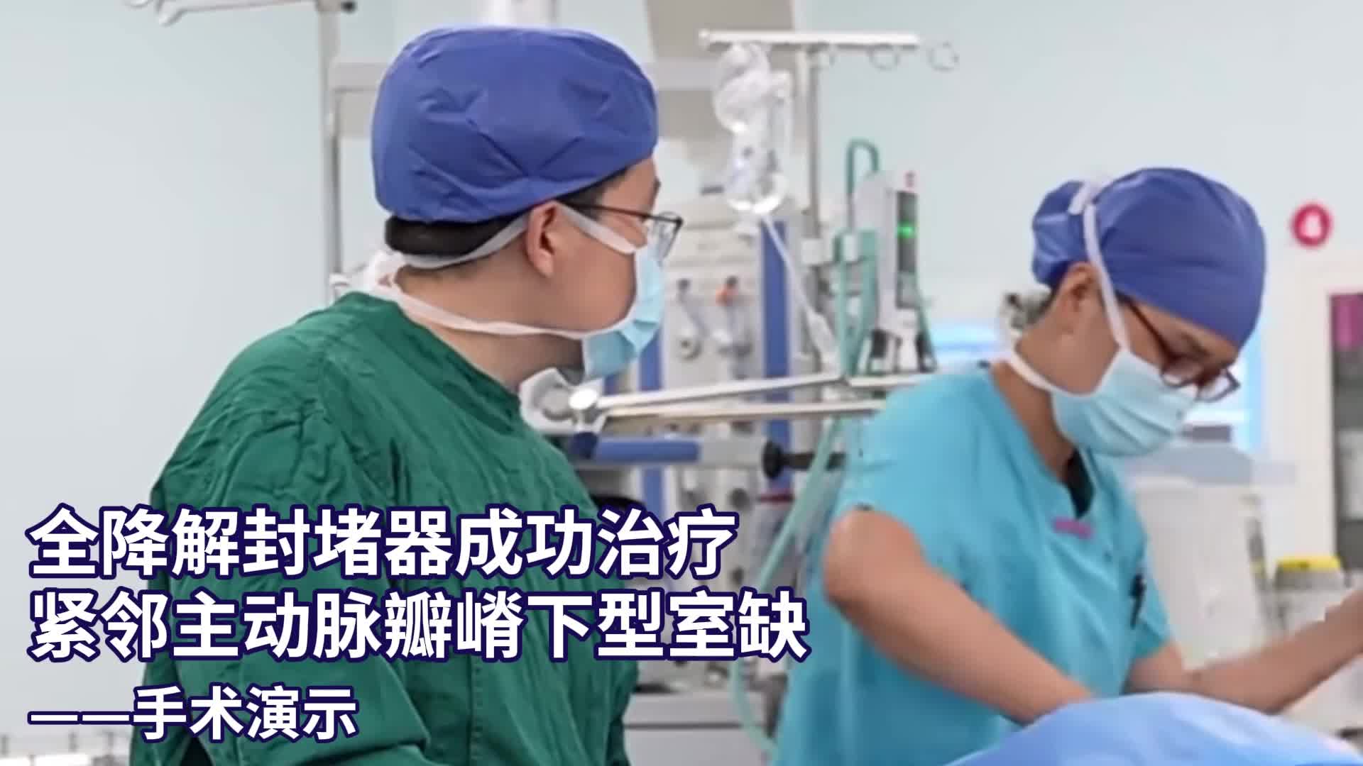 全降解封堵器成功治疗紧邻主动脉瓣嵴下型室缺
